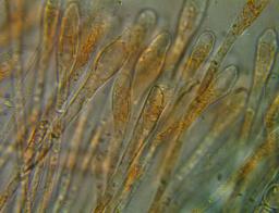 Scutellinia trechispora