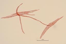 Epichloë typhina