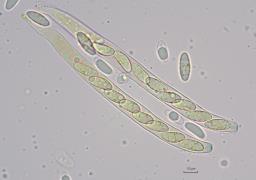 Rutstroemia bolaris