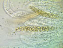 Diatrypella quercina