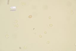 Dermoloma cuneifolium