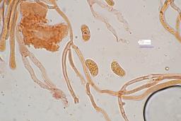 Dacrymyces capitatus
