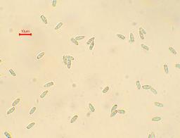 Echinoderma asperum