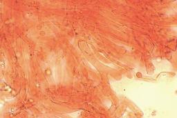 Rhodocollybia prolixa