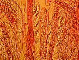 Rutstroemia alnobetulae