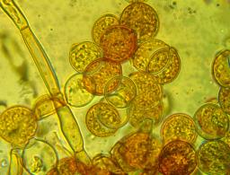 Botryobasidium simile