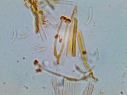 Orbilia auricolor