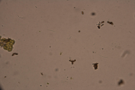Dothistroma septosporum/pini