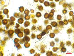 Scleroderma citrinum