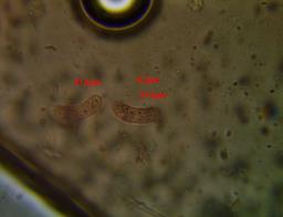 Vuilleminia coryli