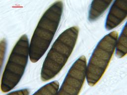 Navicella pileata