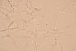 Gloeoporus taxicola