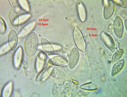Wuestneia chrysostroma