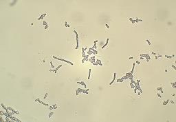 Cephalotrichum stemonitis