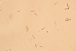Diatrypella favacea