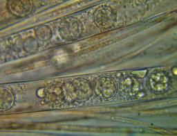 Scutellinia trechispora