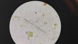 Thyronectria sinopica