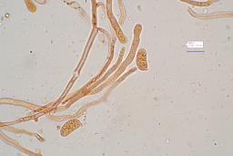 Dacrymyces capitatus