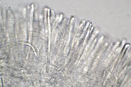 Tapesia lividofusca