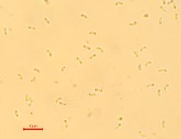 Phlebia tremellosa
