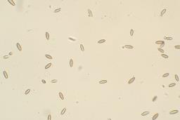 Xerocomellus pruinatus