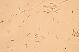 Diatrypella favacea