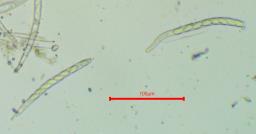 Ciboria coryli