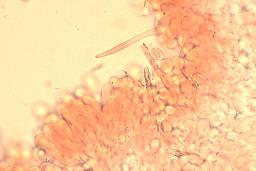 Melanoleuca luteolosperma