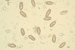 Suillellus luridus
