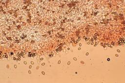 Gymnopilus penetrans