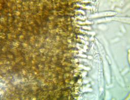 Tapesia lividofusca