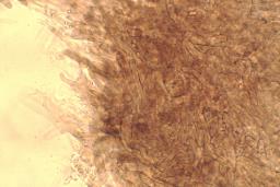 Melanoleuca luteolosperma