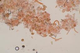 Dacrymyces capitatus
