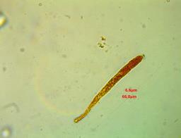 Tapesia lividofusca