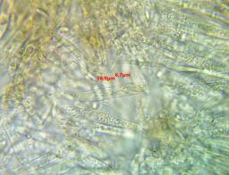 Tapesia lividofusca