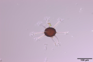 Erysiphe corylacearum