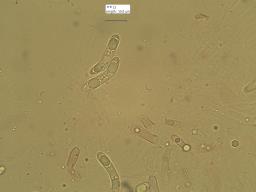 Ruzenia spermoides