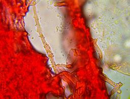Trechispora mollusca