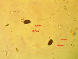 Hypoxylon cercidicola
