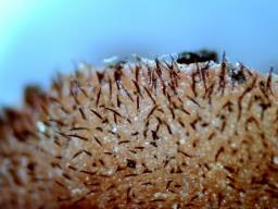 Scutellinia barlae