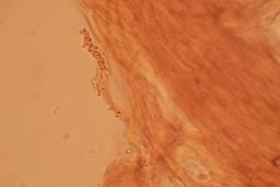 Skeletocutis albocremea