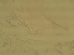 Ruzenia spermoides