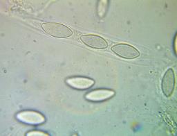 Wuestneia chrysostroma