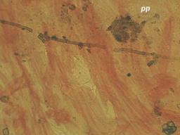Atheniella leptophylla