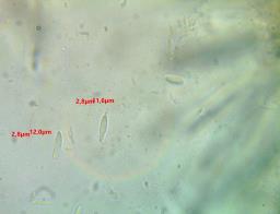 Tapesia lividofusca