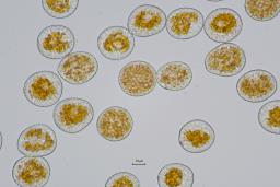Puccinia striiformis