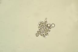 Cephalotrichum stemonitis