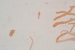 Dacrymyces capitatus