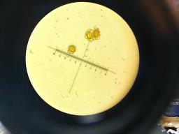 Urocystis colchici