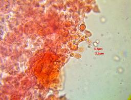 Trechispora mollusca